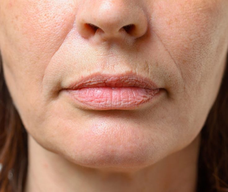 Líneas de marioneta