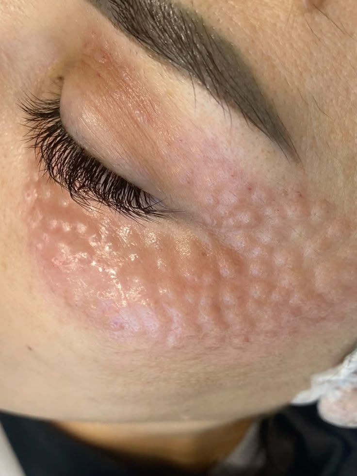 ADN de salmón rostro